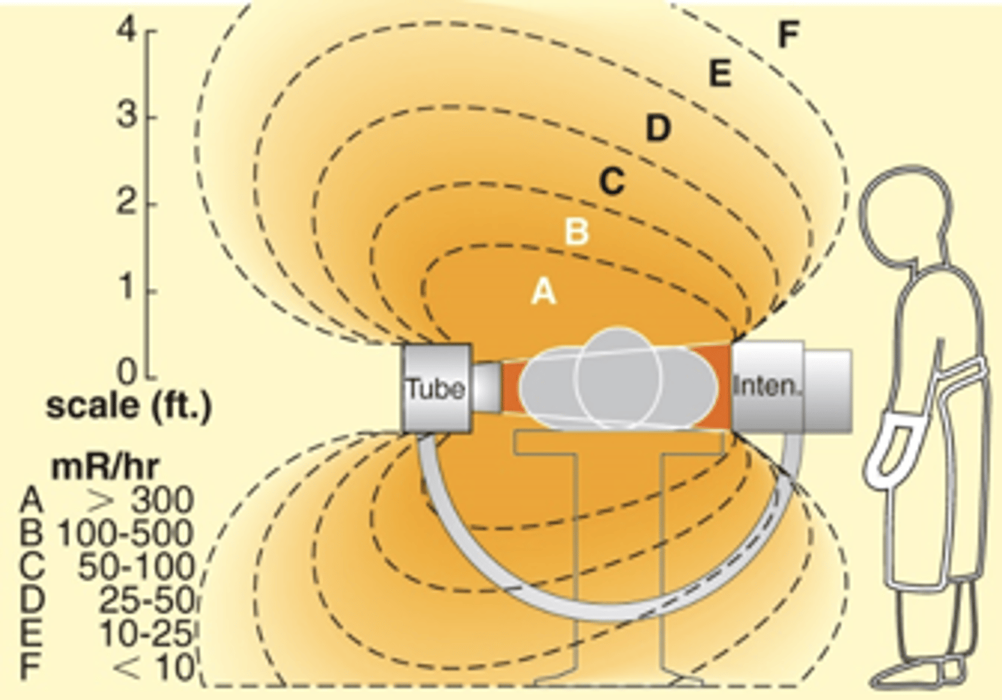 <p>- Increased exposure at x-ray tube end</p>