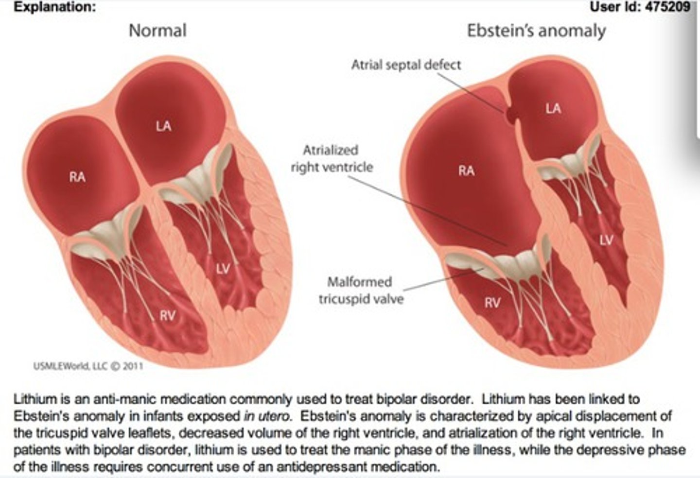 <p>ASD and PFO</p>