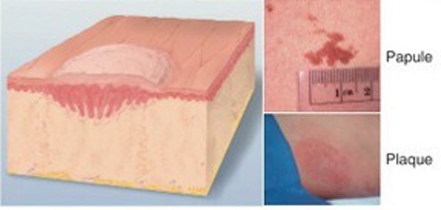 <p>Papule: < 1 cm, solid, elevated, something you CAN FEEL</p><p>Plaque: > 1 cm</p>