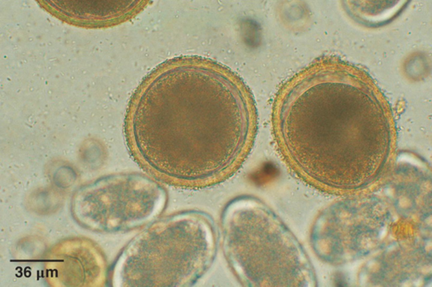 <p>What is the parasite in focus if it is from a dog</p>