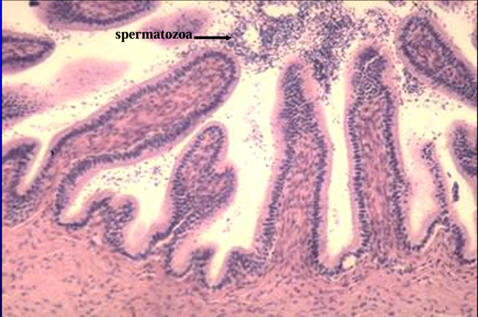 <p>Equine ductus deferens. </p><p>The mucosa is <strong>lined by a simple columnar epithelium. </strong></p><p>Spermatozoa are present in the lumen</p>