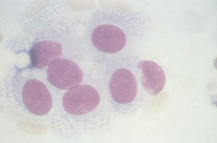 Figure 15: Ependymal cells