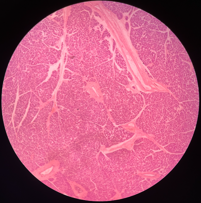 • Located posterior to the stomach.

• Composed of exocrine acini and endocrine islets.