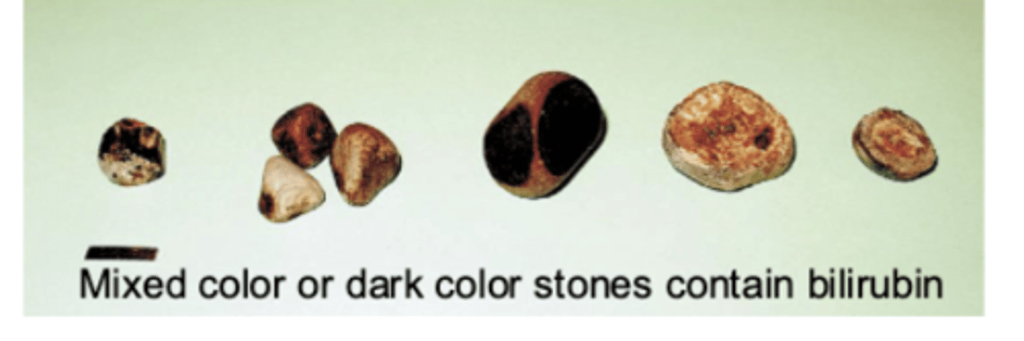 <p>pigment stones ==&gt; contain bilirubin</p>