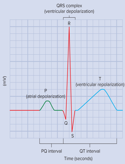 <p>Define electrocardiogram (ECG or EKG)</p>