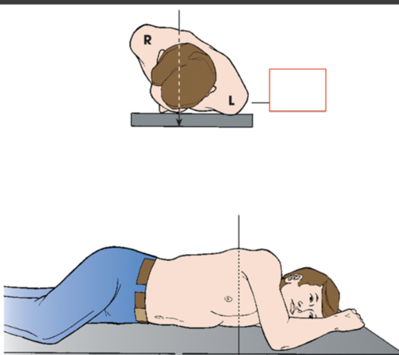 <p>central ray passes through the body / body part through a plane which is at an angle to the transverse plane/coronal plane</p>