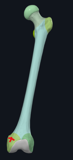<p>What is this called?</p>