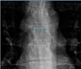 <p>Q what is the name of this measurement? and what is the average + range?</p>
