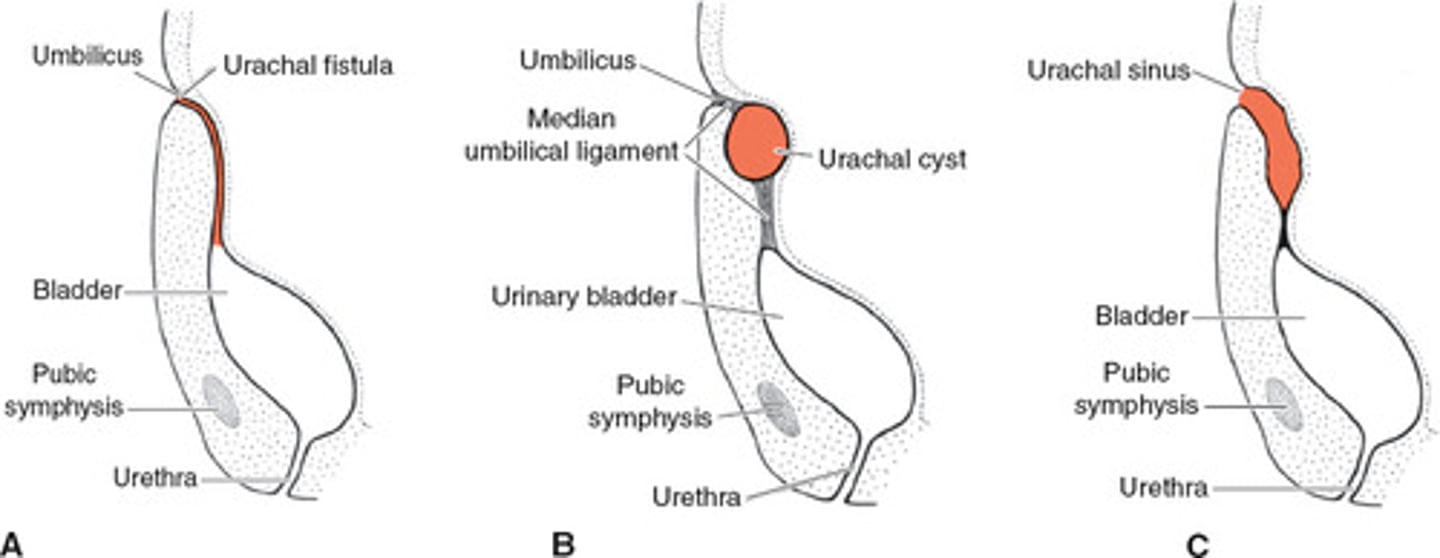 <p>- patent urachus/urachal fistula</p><p>- urachal sinus</p><p>- urachal cyst</p><p>- urachal diverticulum</p>
