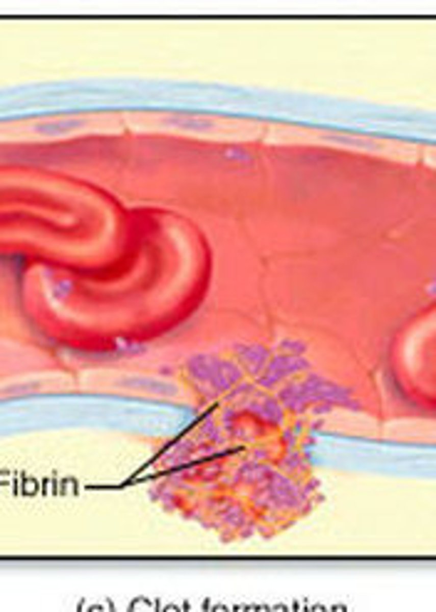 <p>Reinforces platelet plug with fibrin threads</p><p>- Series of reactions use clotting factors (procoagulants), mostly plasma proteins</p><p>---> Numbered I to XIII in order of discovery</p><p>---> Vitamin K needed to synthesize four factors</p><p>- Coagulation occurs in three phases</p><p>1. Two pathways to prothrombin activator</p><p>2. Pathway to thrombin</p><p>3. Common pathway to the fibrin mesh</p>