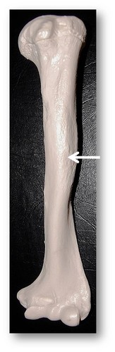 Name this specific part of the humerus.
