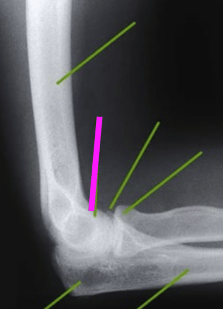 <p>what does the pink line point to?</p>