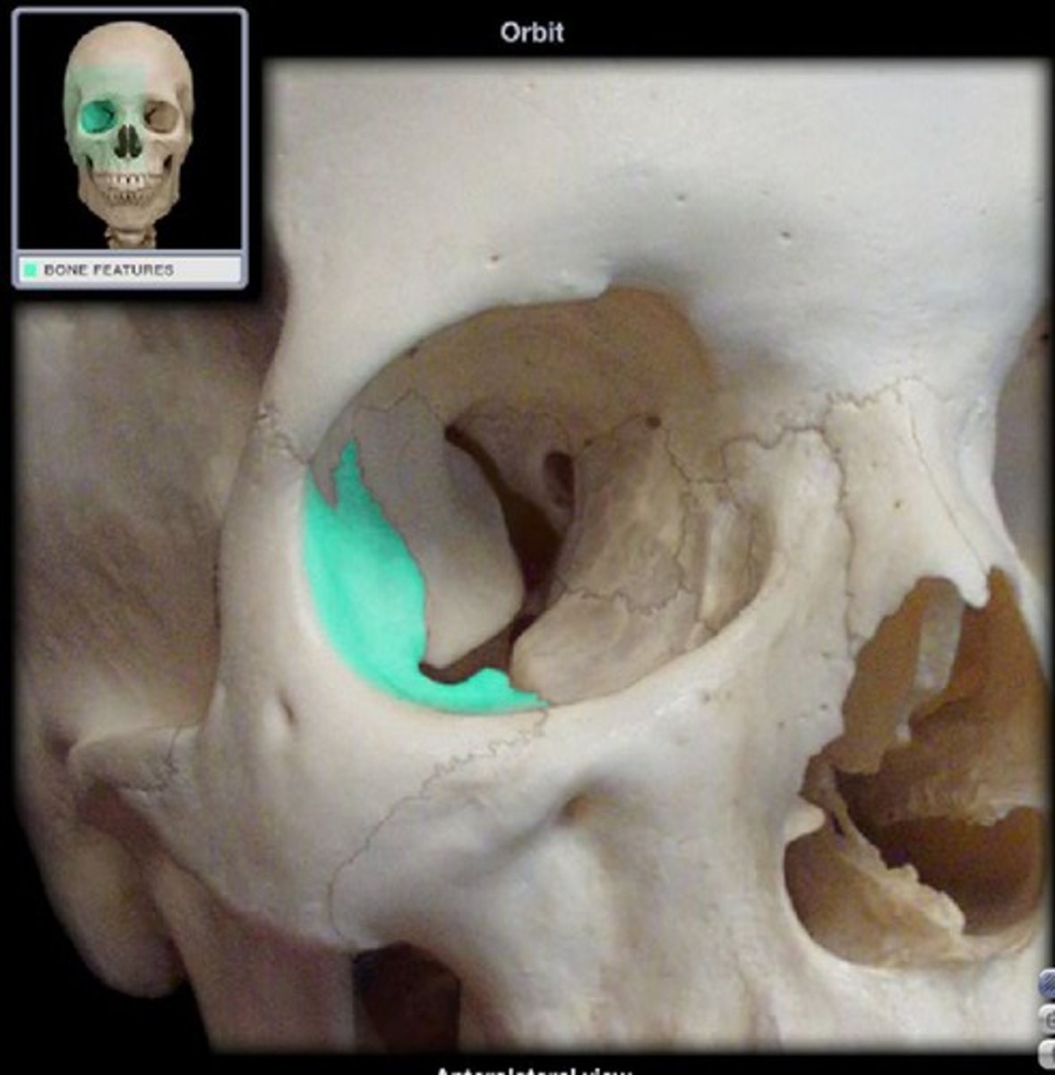 <p>lateral surface of eye orbits</p>