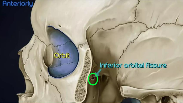 <p><strong>Anteriorly</strong>, the pterygopalatine fossa communicates with the _____ via the medial end of inferior orbital fissure</p>