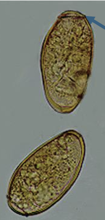 <p>similar to diphylloborthriidean eggs</p>