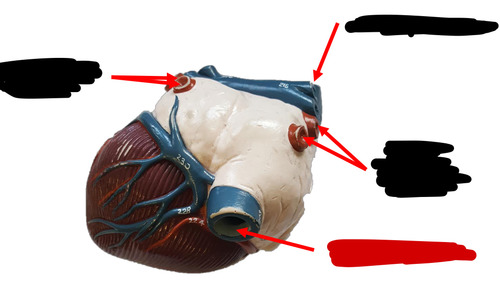 <p>Name this heart vessel</p>