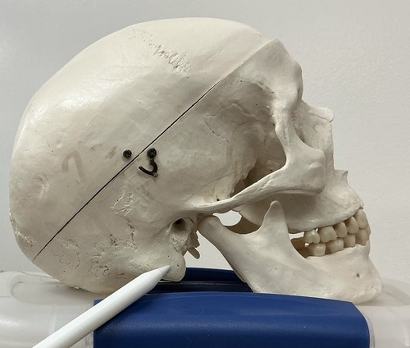 <p>What is the arrow pointing to?</p>