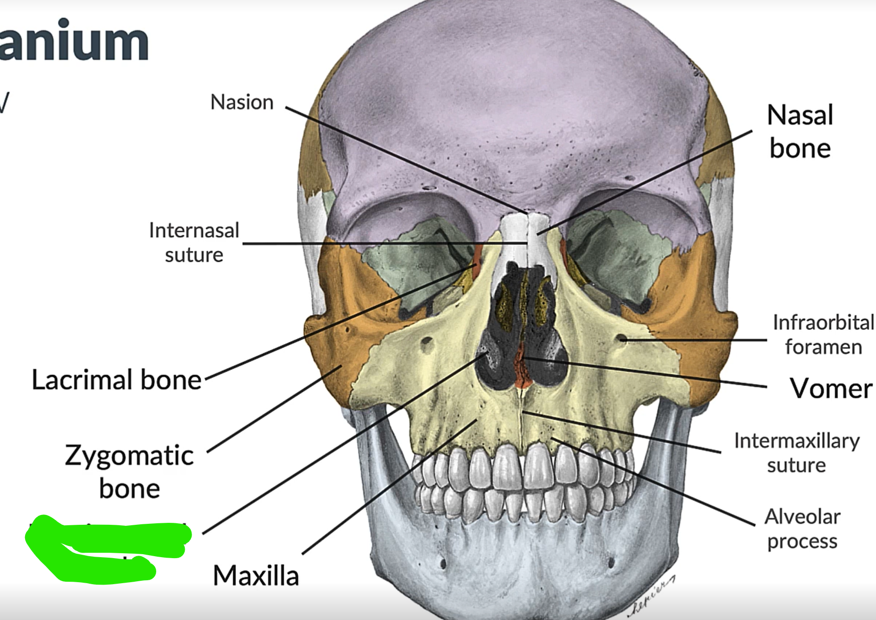 term image