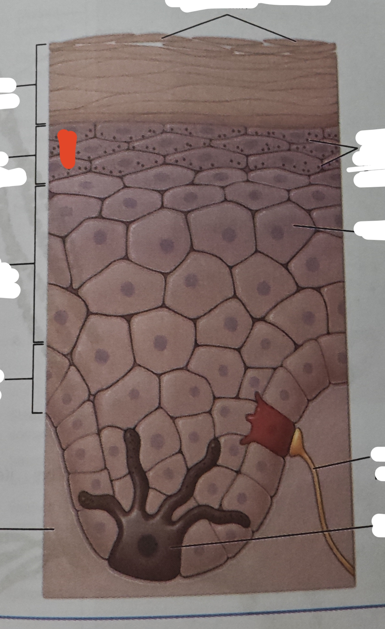 <p>named for its granular appearance</p>