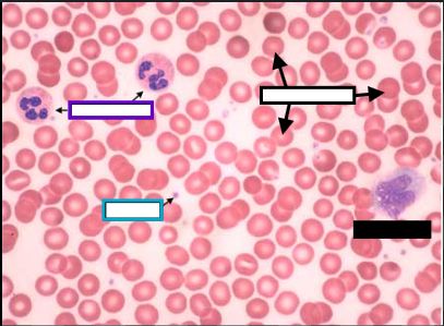 <p>What is the purple box arrow pointing at?</p>