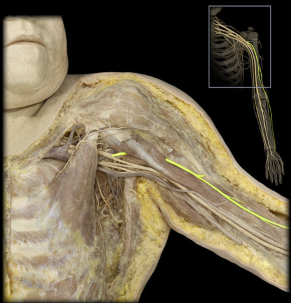 <p><em>table 5, lateral cord terminal branch, </em><span><em>supplies flexor compartment of arm</em></span></p>