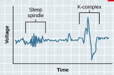 <p>NREM Stage 2</p>