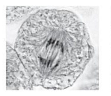 <p>what is that phase of mitosis</p>