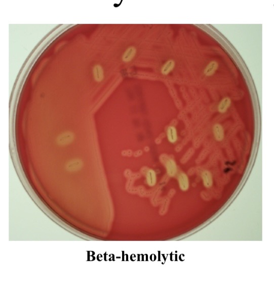 <p>Beta hemolysis</p>