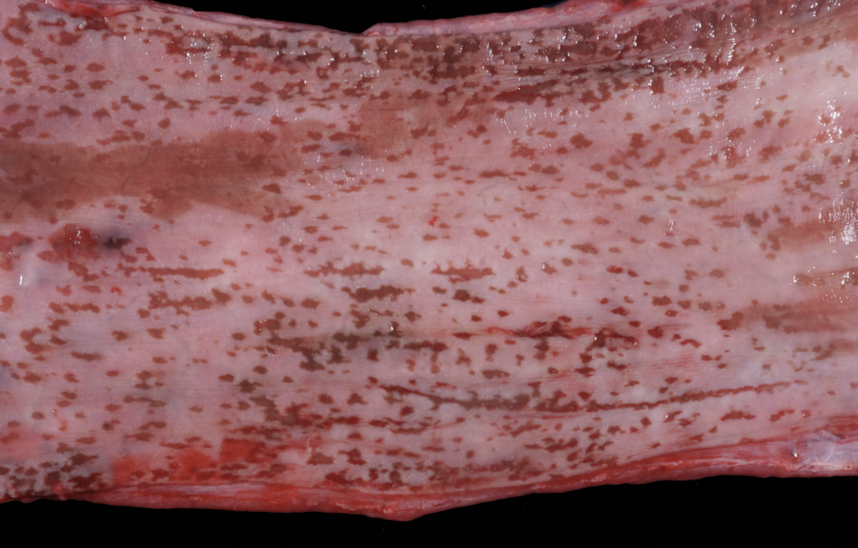 <p><span style="background-color: transparent;">Esophagus of a 6 month old Angus bull calf that was experiencing diarrhea and a low body temperature.&nbsp;</span></p><p><span style="background-color: transparent;">What is the distribution of the lesion?&nbsp; +&nbsp; Using DAMNIT-V, what is the most likely cause of the lesion?</span></p>