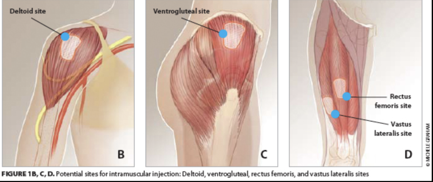 <ul><li><p>deltoid</p></li><li><p>vastus lateralis + rectus femoris (thigh)</p></li><li><p>ventral gluteal</p></li></ul><p></p>