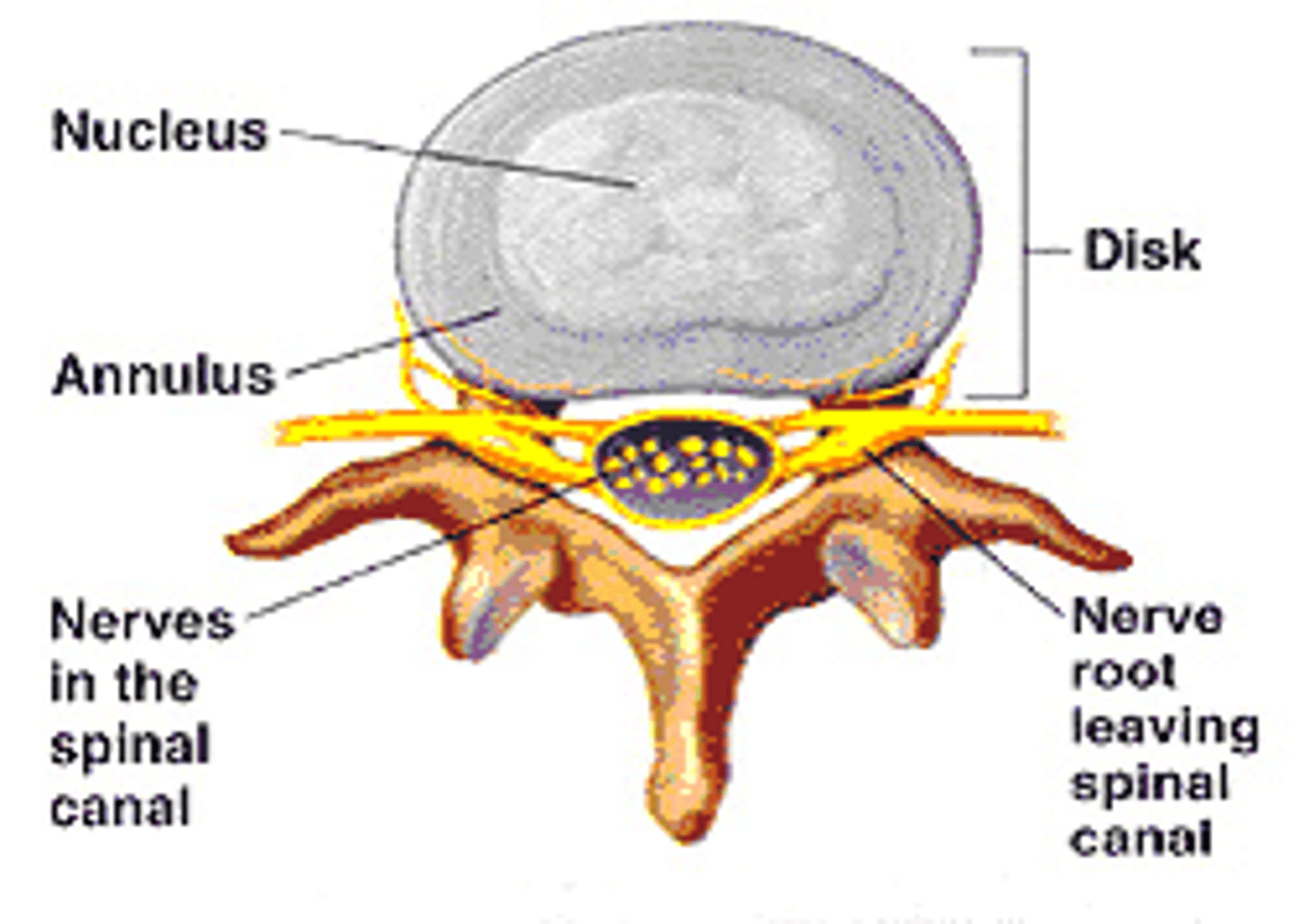 <p>Outside ring: Annulus Fibrosis</p><p>Inside (jelly like): Nucleus Pulpous</p>