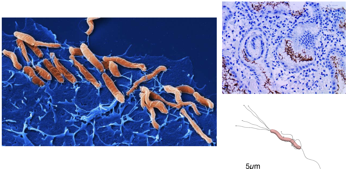 <p>What is this bacteria and what disease does it cause?</p>