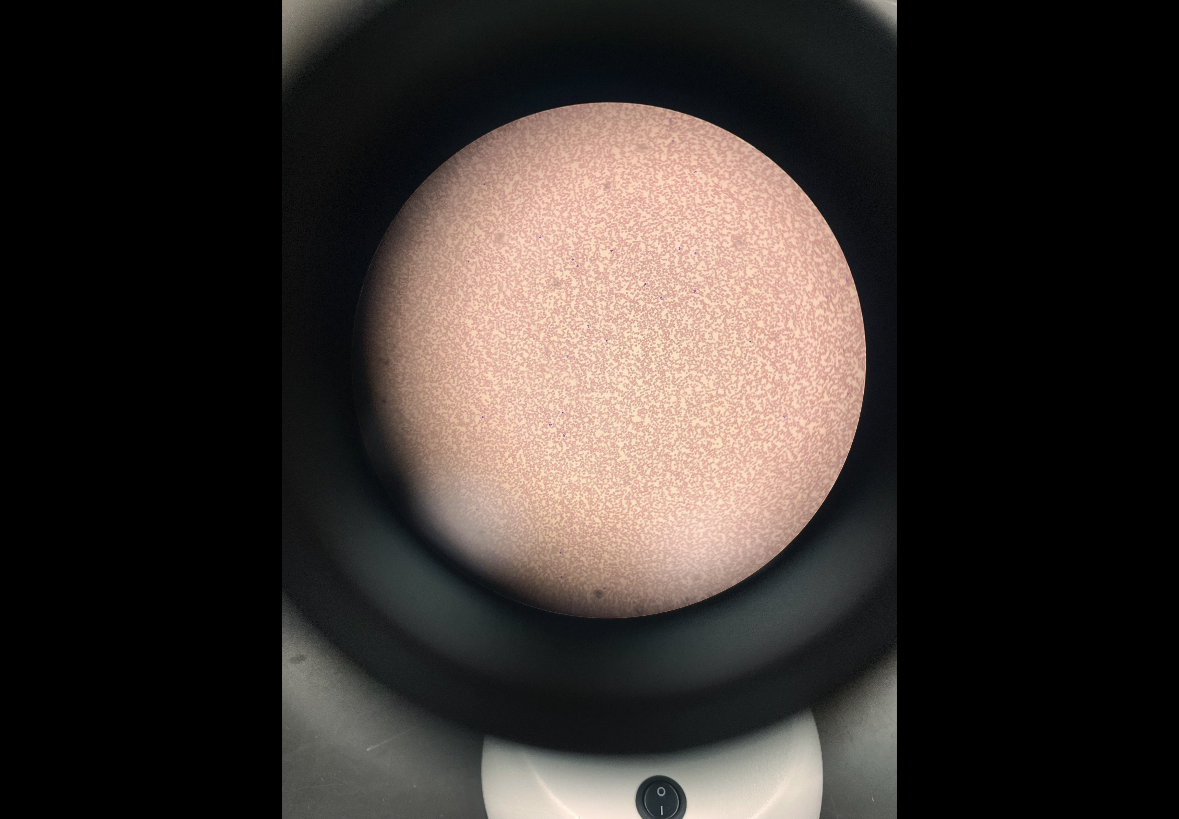 <p>Body location: within the chambers of the heart</p>