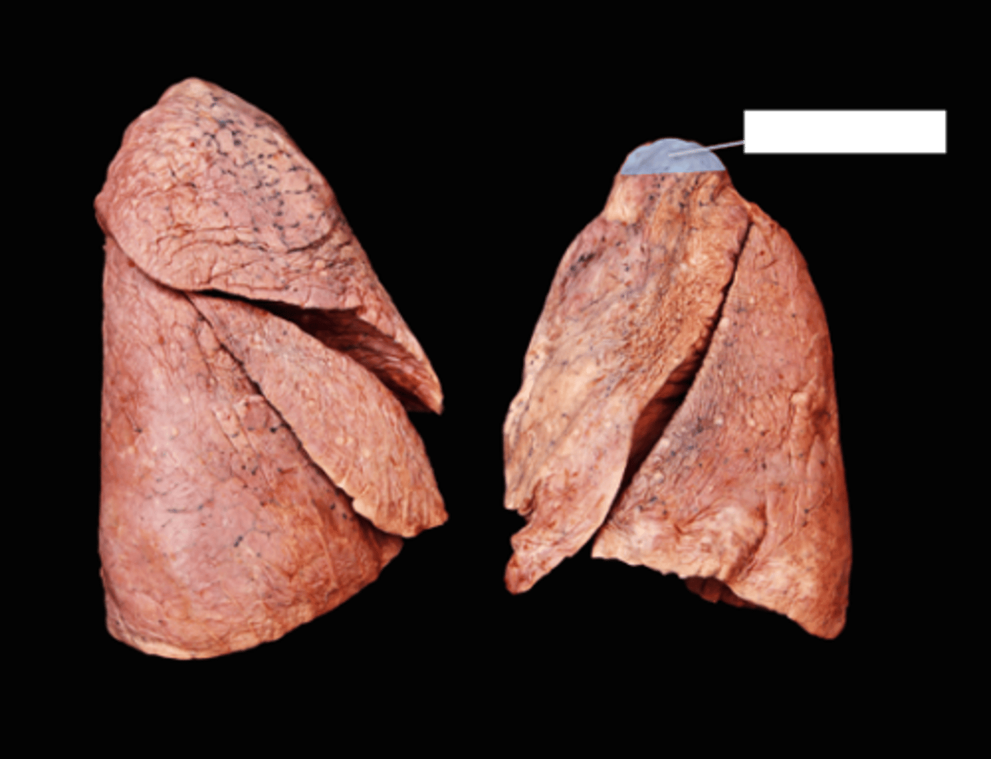 <p>Label the Lung Segment</p>