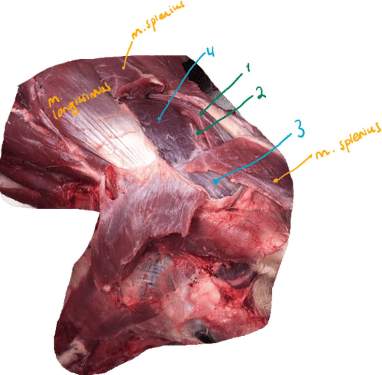 <p>what short muscles are located here? <em>They are located between the atlantooccipital and atlantoaxial joint.</em> </p>