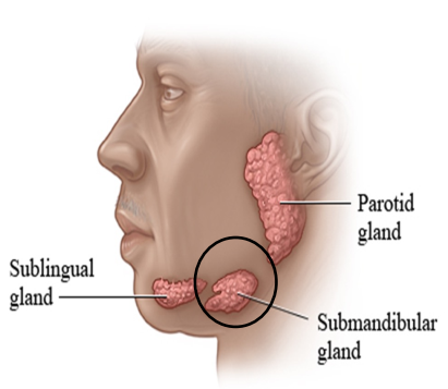 <ul><li><p>Second largest of the major salivary glands</p></li><li><p>Encapsulated</p></li><li><p>contains mixed glands = serous demilune</p></li><li><p>Located beneath mandible </p></li></ul><p>Secretions: mainly serous and some mucous secretions; contributing 60-65% of saliva into oral cavity </p><p></p>
