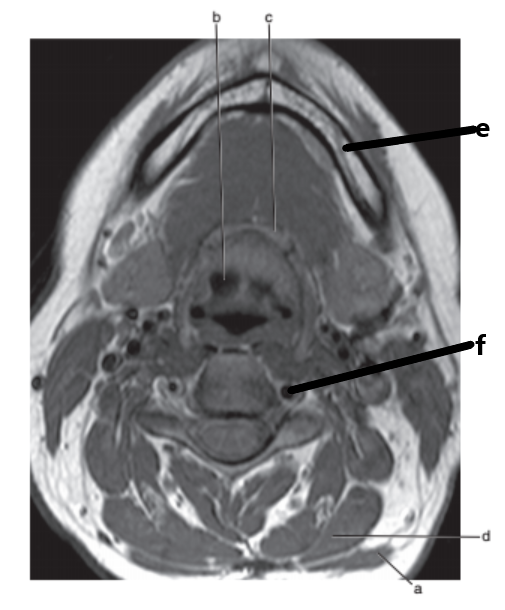<p>What is letter f ?</p>