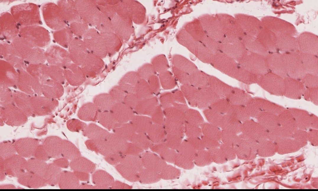 <p>Tejido muscular esquelético corte transversal</p>