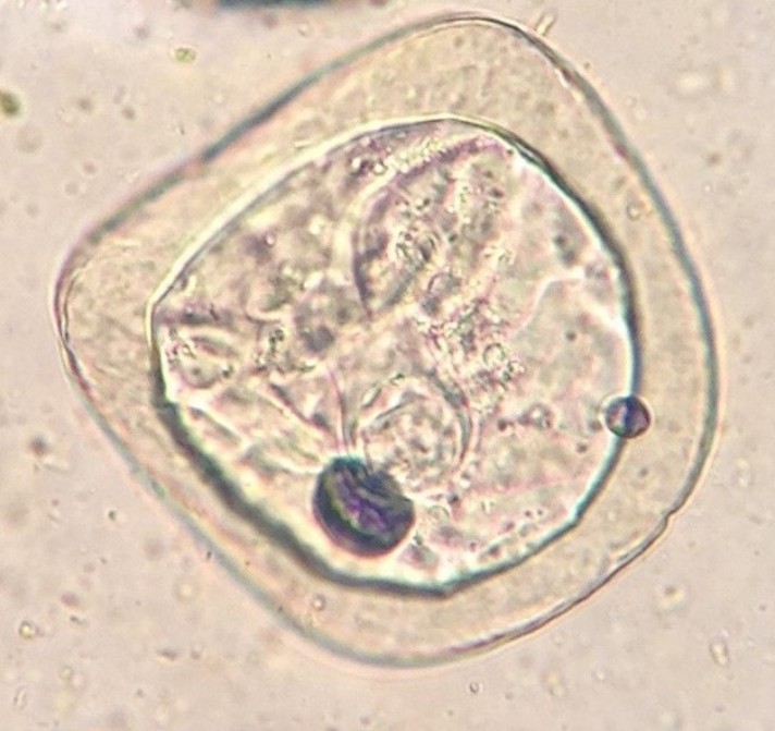 <p><strong>Moniezia spp.</strong></p>