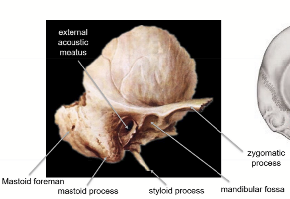 <ul><li><p>external acoustic meatus</p></li><li><p>mastoid forament</p></li><li><p>mastoid process (attachment for sternocleidomastoid muscle)</p></li><li><p>styloid procces</p></li><li><p>mandibular fossa</p></li><li><p>zygomatic process</p></li></ul><p></p>