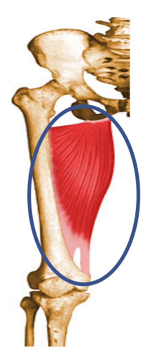 <p>extend thigh at hip</p>