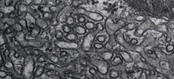 <p>What type of ER is this?</p>