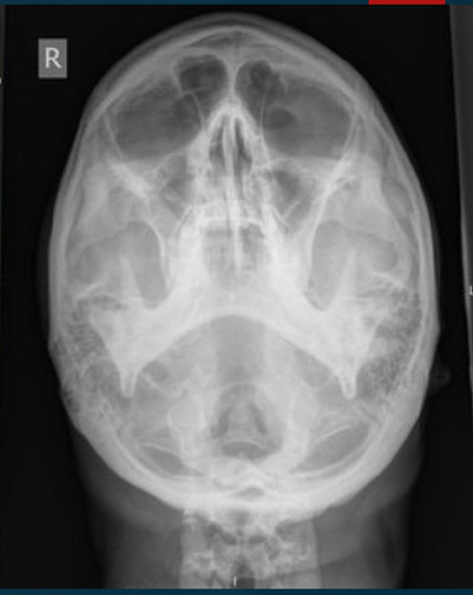 <p>What projection view is this?</p>