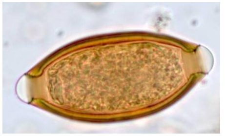 <p>Nematode - whipworm</p>