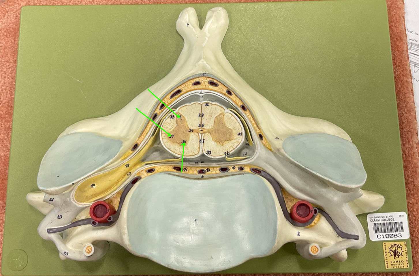 <p>top to bottom</p>