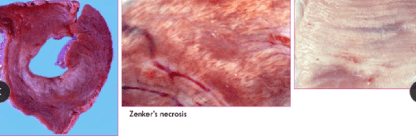 <p>gritty,, white to off white granules to streaks</p><p>to larger calcified nodules</p>