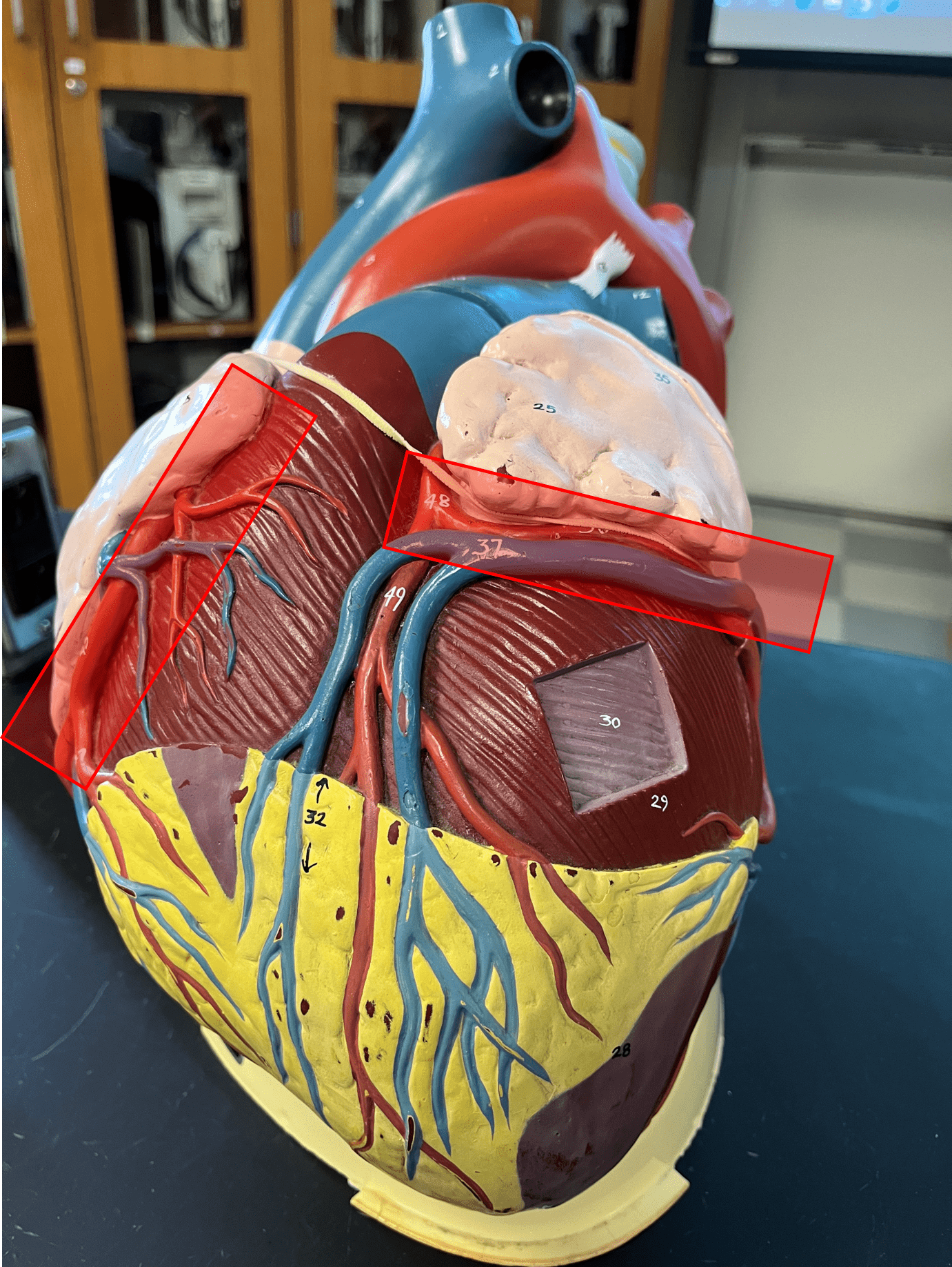 • Sulcus dividing the atria and ventricles of the heart.

• Contains the coronary sinus.

• Also known as the atrioventricular groove.