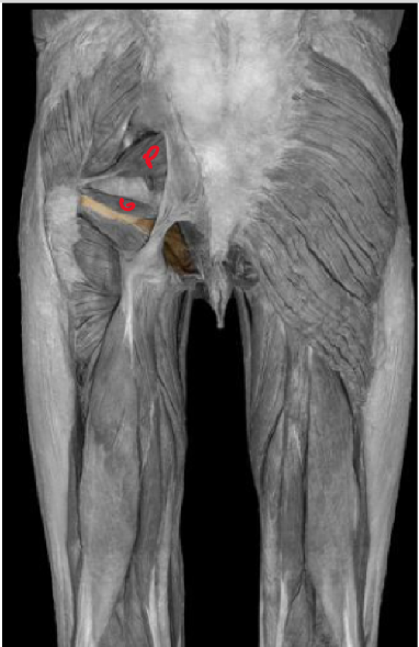 <p>obturator internus </p>