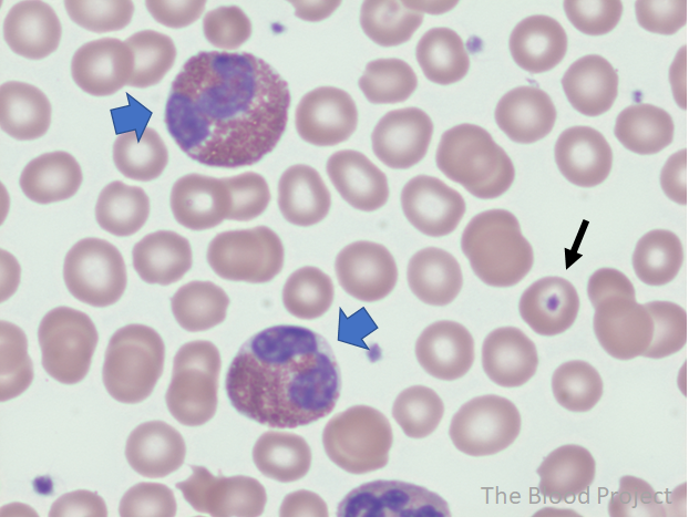 <p><strong>Name</strong>: Eosinophil (Granulocyte)</p><p><strong>Percent</strong>: 2-4%</p><p><strong>Function</strong>: targets parasitic worms</p><p>live span- several days</p><p>☆☆<span style="color: red;">Pretty :)</span>☆☆</p>