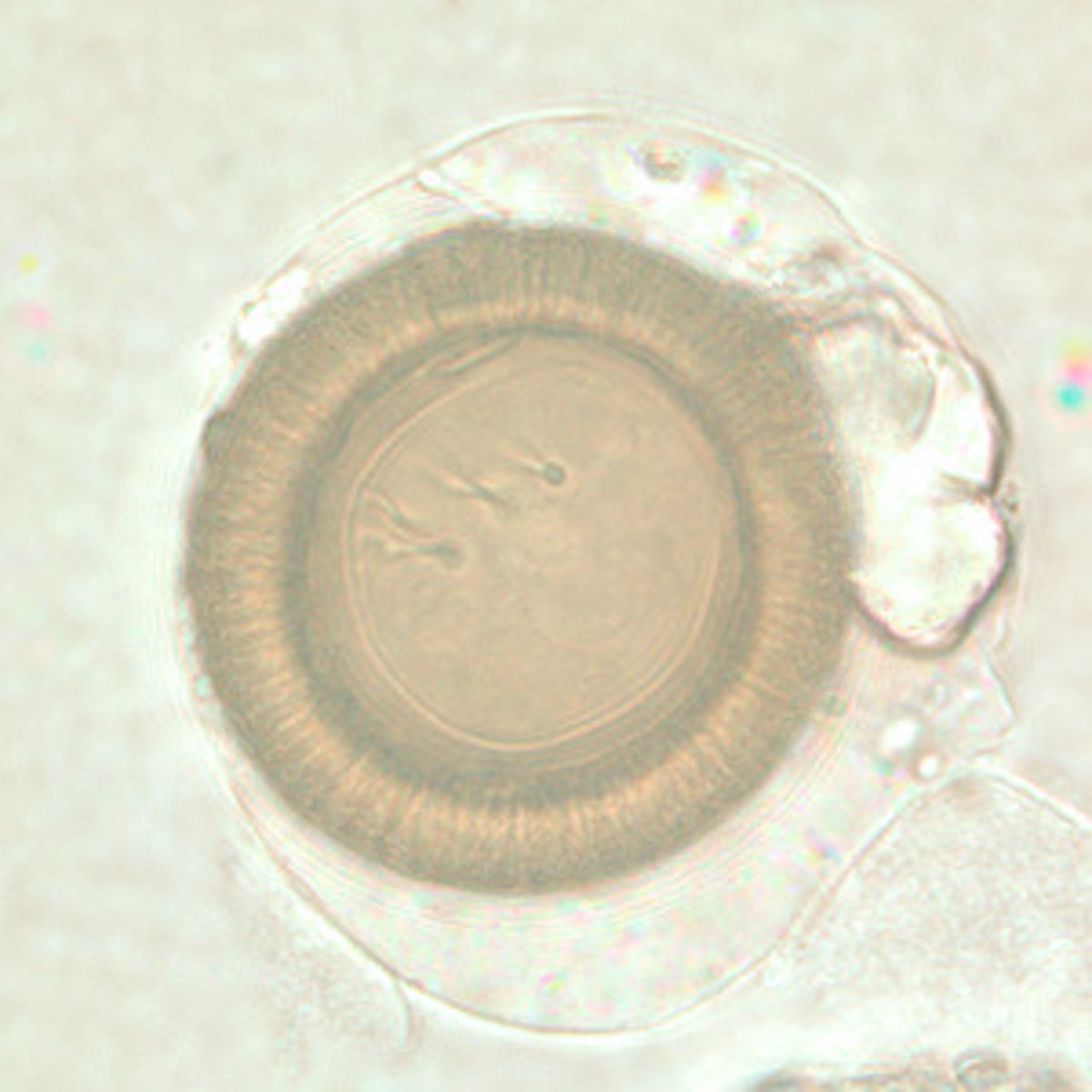 <p>*3 slightly visible hooks in center<br>*yellowish striations in embryo</p>